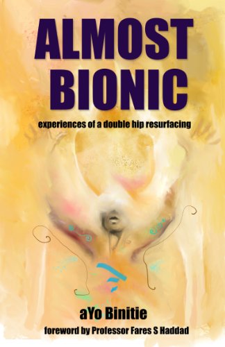 Almost Bionic, experiences of a double hip resurfacing