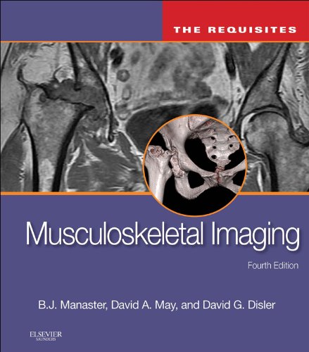 Musculoskeletal Imaging: The Requisites (Requisites in Radiology)