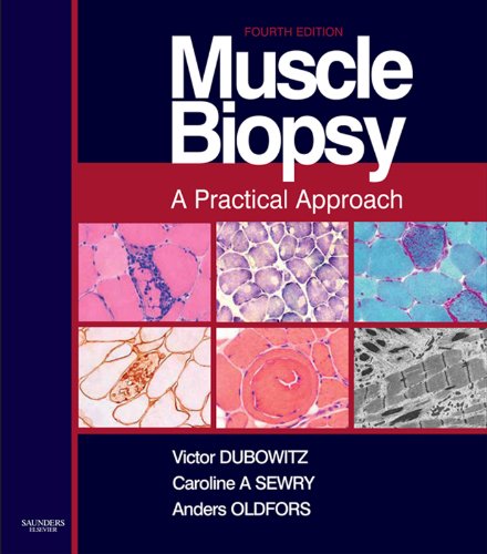 Muscle Biopsy: A Practical Approach
