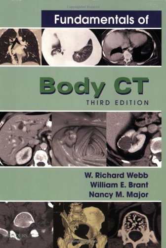 Fundamentals of Body Ct (3rd Edition) 3rd (third) Edition by W. Richard Webb, William Brant, Nancy Major (2005)