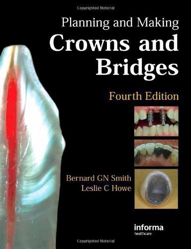 Planning and Making Crowns and Bridges by Smith, Bernard G. N., Howe, Leslie C. [05 October 2006]