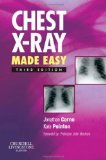 Chest X-Ray Made Easy, 3e by Corne MA PhD FRCP Dr., Jonathan, Pointon MRCP FRCR, Kate [01 October 2009]