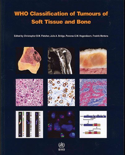 WHO Classification of Tumours of Soft Tissue and Bone (IARC WHO Classification of Tumours) 4th (fourth) Edition by IARC (2013)