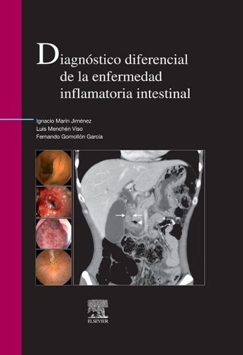 DiagnÃ³stico diferencial de la enfermedad inflamatoria intestinal (Spanish Edition)