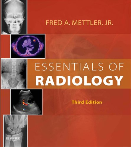 Essentials of Radiology (Mettler, Essentials of Radiology)