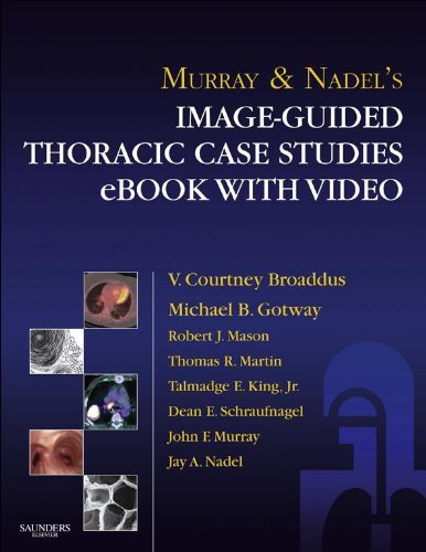 Murray & Nadel's Image-Guided Thoracic Case Studies  with Video