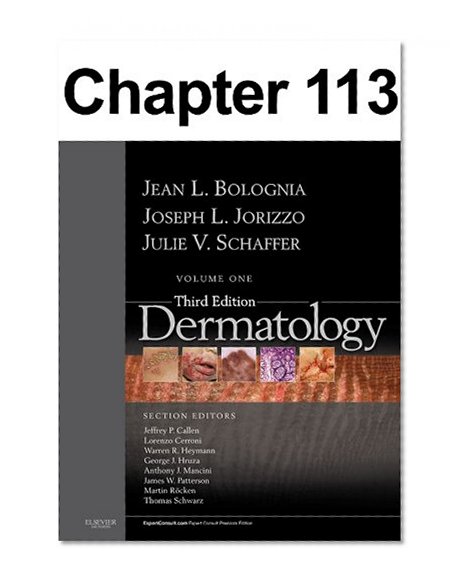 Melanoma: Chapter 113 of Dermatology