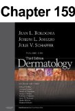 Botulinum Toxin: Chapter 159 of Dermatology