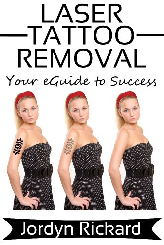 Laser Tattoo Removal - Your eGuide to Success