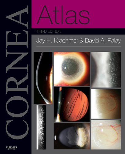 Cornea Atlas (Expert Consult)