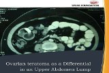 Ovarian teratoma as a Differential in an Upper Abdomen Lump (IJMPR Book 1)