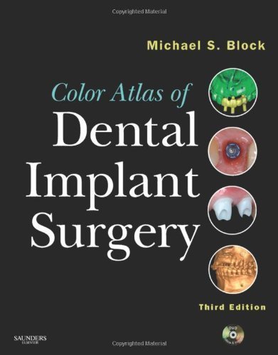 Color Atlas of Dental Implant Surgery, 3e 3rd (third) Edition by Block DMD, Michael S. published by Saunders (2010)