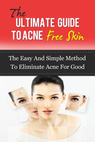 The Ultimate Guide To Acne Free Skin: The Easy And Simple Method To Eliminate Acne For Good (Acne Treatment, Acne Diet)