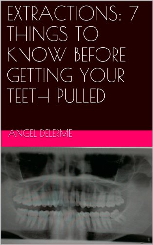 EXTRACTIONS: 7 THINGS TO KNOW BEFORE GETTING YOUR TEETH PULLED