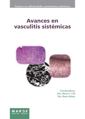 Avances en vasculitis sistÃ©micas (Spanish Edition)