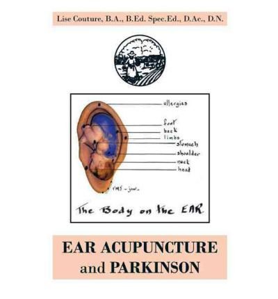 EAR ACUPUNCTURE and PARKINSON (Paperback) - Common
