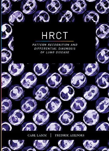 HRCT - Pattern Recognition and Differential Diagnosis of Lung Disease