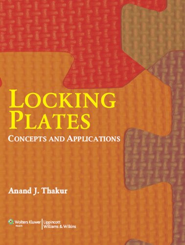 Locking Plates: Concepts and Applications