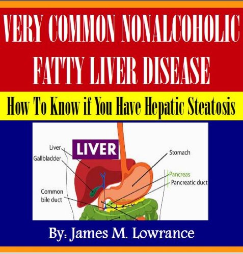 Very Common NonAlcoholic Fatty Liver Disease