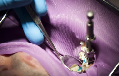 DENTAL MATERIALS - Restorative Materials; Dental Resins, Miscellaneous Dental Materials, and Dental Gold/Alloys; Gypsum Products, Dental Waxes, and Impression Materials