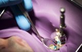 DENTAL MATERIALS - Restorative Materials; Dental Resins, Miscellaneous Dental Materials, and Dental Gold/Alloys; Gypsum Products, Dental Waxes, and Impression Materials