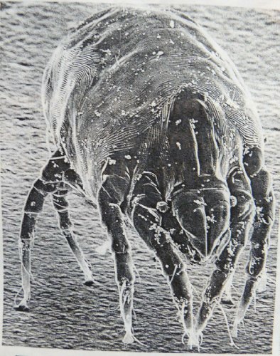Winning the War on Dust Mites