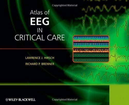 Atlas of EEG in Critical Care by Hirsch, Lawrence Published by Wiley 1st (first) edition (2010) Hardcover