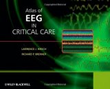 Atlas of EEG in Critical Care by Hirsch, Lawrence Published by Wiley 1st (first) edition (2010) Hardcover