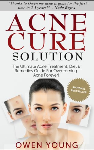 Acne Cure Solution: The Ultimate Acne Treatment, Diet & Remedies Guide For Overcoming Acne Forever! (Acne Diet, Acne Remedies, Acne No More)