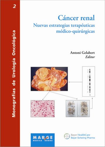 CÃ¡ncer renal. Nuevas estrategias terapÃ©uticas mÃ©dico-quirÃºrgicas (Spanish Edition)