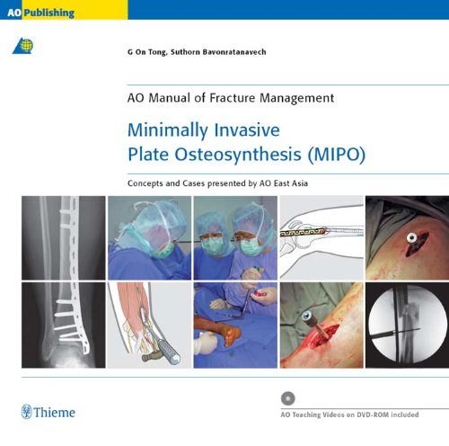 Minimally Invasive Plate Osteosynthesis (MIPO): Concepts and cases presented by the AO East Asia (AO Co-Publications)