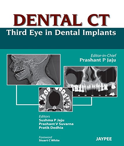 Dental CT: Third Eye in Dental Implants