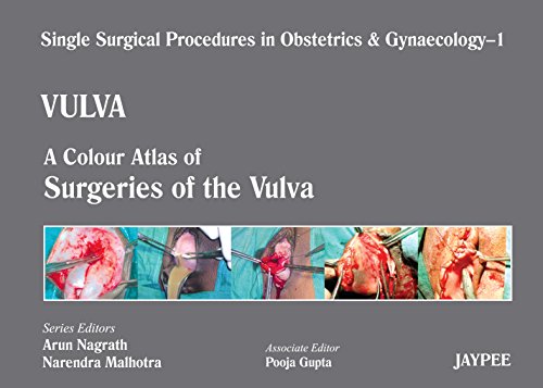 A Colour Atlas of Surgeries of the Vulva  (Volume 1) (Single Surgical Procedures in Obstetrics and Gynaecology)