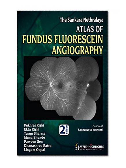 The Sankara Nethralaya Atlas of Fundus Fluorescein Angiography