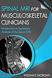 Introduction to Systematic Analysis of the Spinal MRI (Spinal MRI for Musculoskeletal Clinicians Book 1)