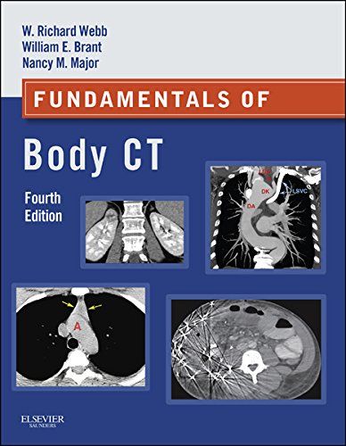 Fundamentals of Body CT: Expert Consult (Fundamentals of Radiology)