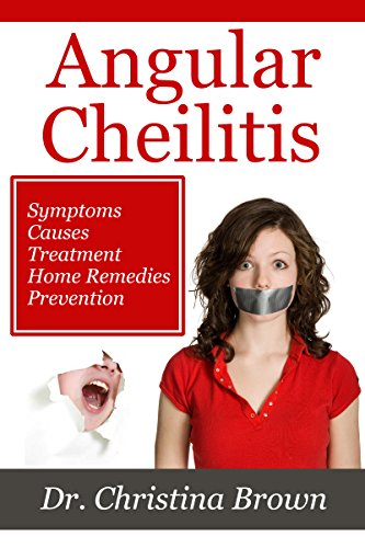 Angular Cheilitis: Symptoms, Causes,Treatment, Home Remedies, Prevention