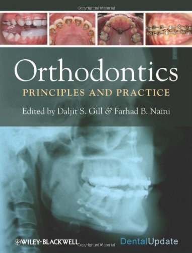Orthodontics: Principles and Practice by Gill, Daljit, Naini, Farhad B. (2011) Hardcover