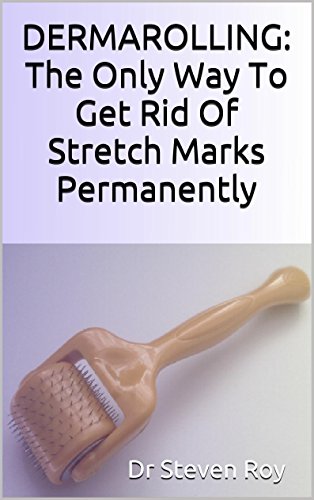 DERMAROLLING: The Only Way To GetÂ Rid Of Stretch Marks Permanently Â : Step by step guide to remove your stretch marks