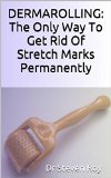 DERMAROLLING: The Only Way To GetÂ Rid Of Stretch Marks Permanently Â : Step by step guide to remove your stretch marks