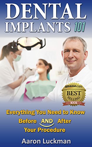 Dental Implants 101: Everything You Need to Know Before AND After Your Procedure!