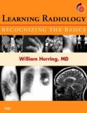 Learning Radiology: Recognizing the Basics (With STUDENT CONSULT Online Access), 1e 1 Pap/Psc by Herring MD, William (2007) Paperback