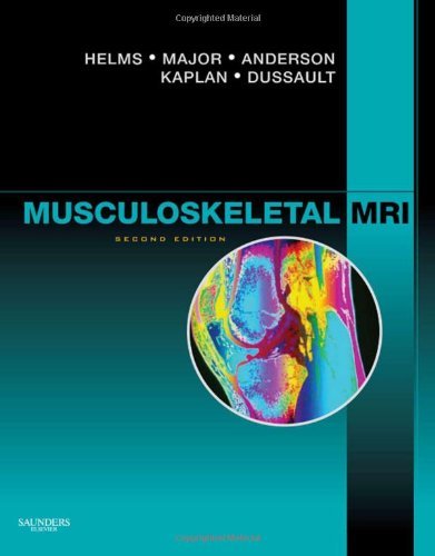 Musculoskeletal MRI, 2e 2nd (second) by Helms MD, Clyde A., Major MD, Nancy M., Anderson MD, Mark W. (2008) Hardcover