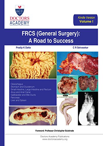 FRCS (General Surgery): The Road to Success (Kindle Edition): Volume I