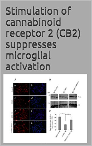 Stimulation of cannabinoid receptor 2 (CB2) suppresses microglial activation