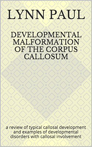 Developmental malformation of the corpus callosum: a review of typical callosal development and examples of developmental disorders with callosal involvement