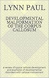Developmental malformation of the corpus callosum: a review of typical callosal development and examples of developmental disorders with callosal involvement