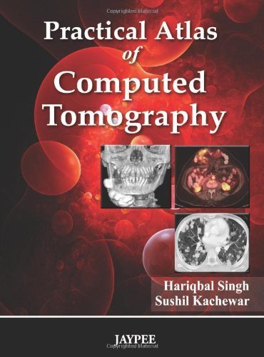 Practical Atlas of Computed Tomography 1st Edition by Singh, Hariqbal, M.D., Kachewar, Sushil, M.D. (2010) Hardcover