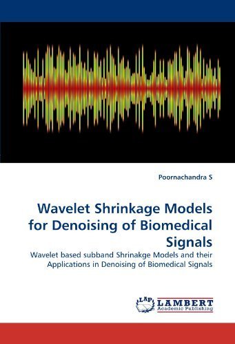 Wavelet Shrinkage Models for Denoising of Biomedical Signals: Wavelet based subband Shrinakge Models and their Applications in Denoising of Biomedical Signals by S, Poornachandra (2010) Paperback