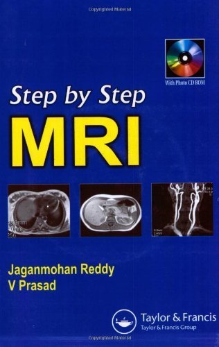 Step by Step MRI Min Pap/CD edition by Reddy, Jagan Mohan, Prasad, V. (2005) Paperback